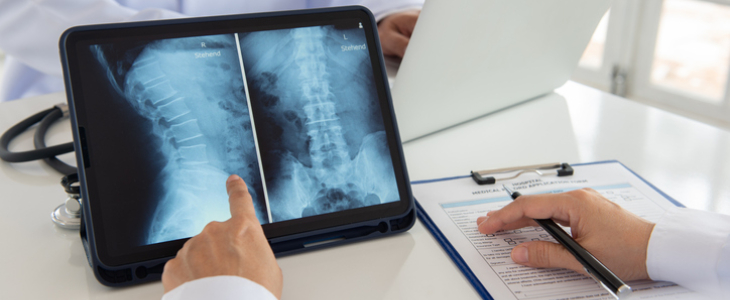 Doctor pointing to an x-ray scan of the spinal cord