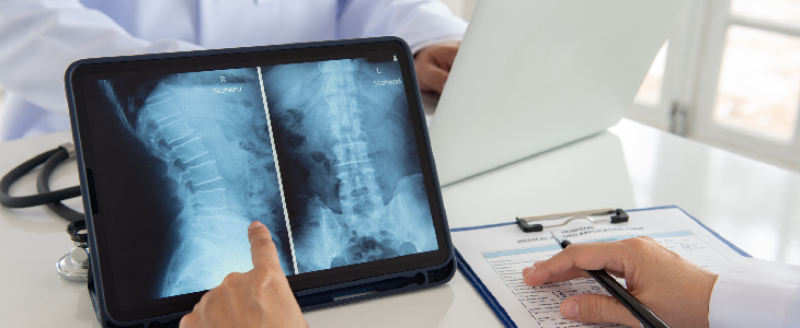 Doctor checking the patients spinal cord